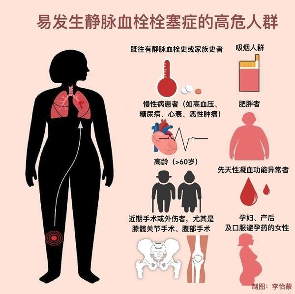 春运长时间乘车乘机,这些防血栓知识请记好