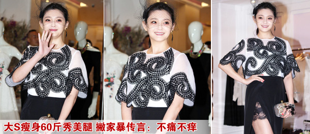 大S瘦身60斤秀美腿 撇家暴传言：不痛不痒