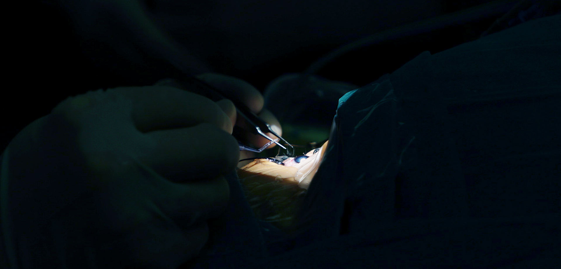 &ldquo;6.6爱眼日&rdquo;：走近眼科医生的日常