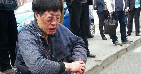 跟腚儿按喇叭 司机遭前车2男2女殴打