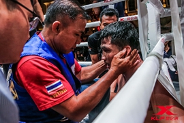 &ldquo;金童&rdquo;谢幕？深度解读江佟猜的失利