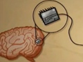 植入小小装置 人脑电脑直接沟通